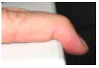 Prueba de la rehabilitación del tendón del dedo