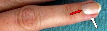 Anatomía del dedo humano